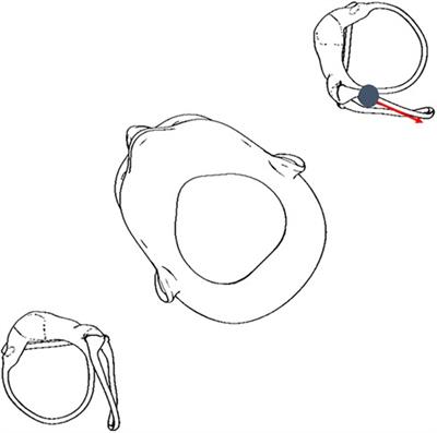 Case Report: Keep your eyes open! Nystagmus guides atypical BPPV